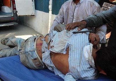 فرو رفتن میلگرد ۲ متری در بدن کارگر افغان +عکس