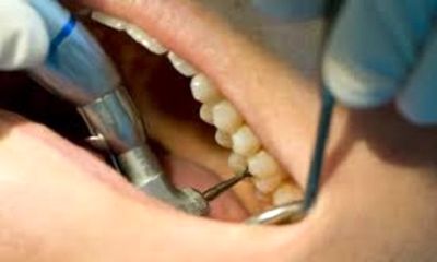 کیفیت آموزش دندانپزشکی ایران بالاتر از کشورهای اروپایی