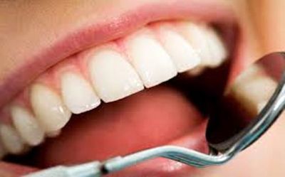 شاخص پوسیدگی دندان در کشور افزایش یافته است