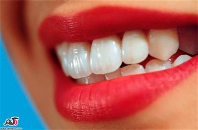 این ویتامین محافظ دندان‌های شماست