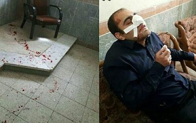 ضرب و شتم معلم خوزستانی توسط پدر دانش‌آموز +عکس