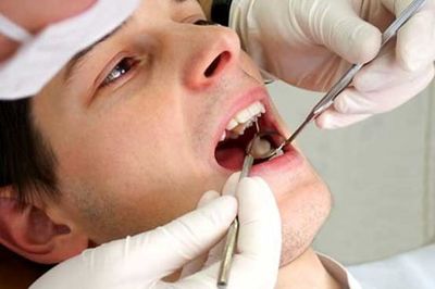 ۲۰۰ میلیون دندان پوسیده در دهان ایرانی‌ها