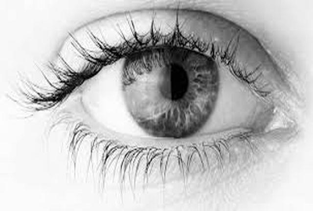 علائم و درمان عفونتی خفیف در چشمانتان