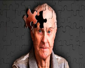 عامل ژنتیکی بیماری آلزایمر شناسایی شد